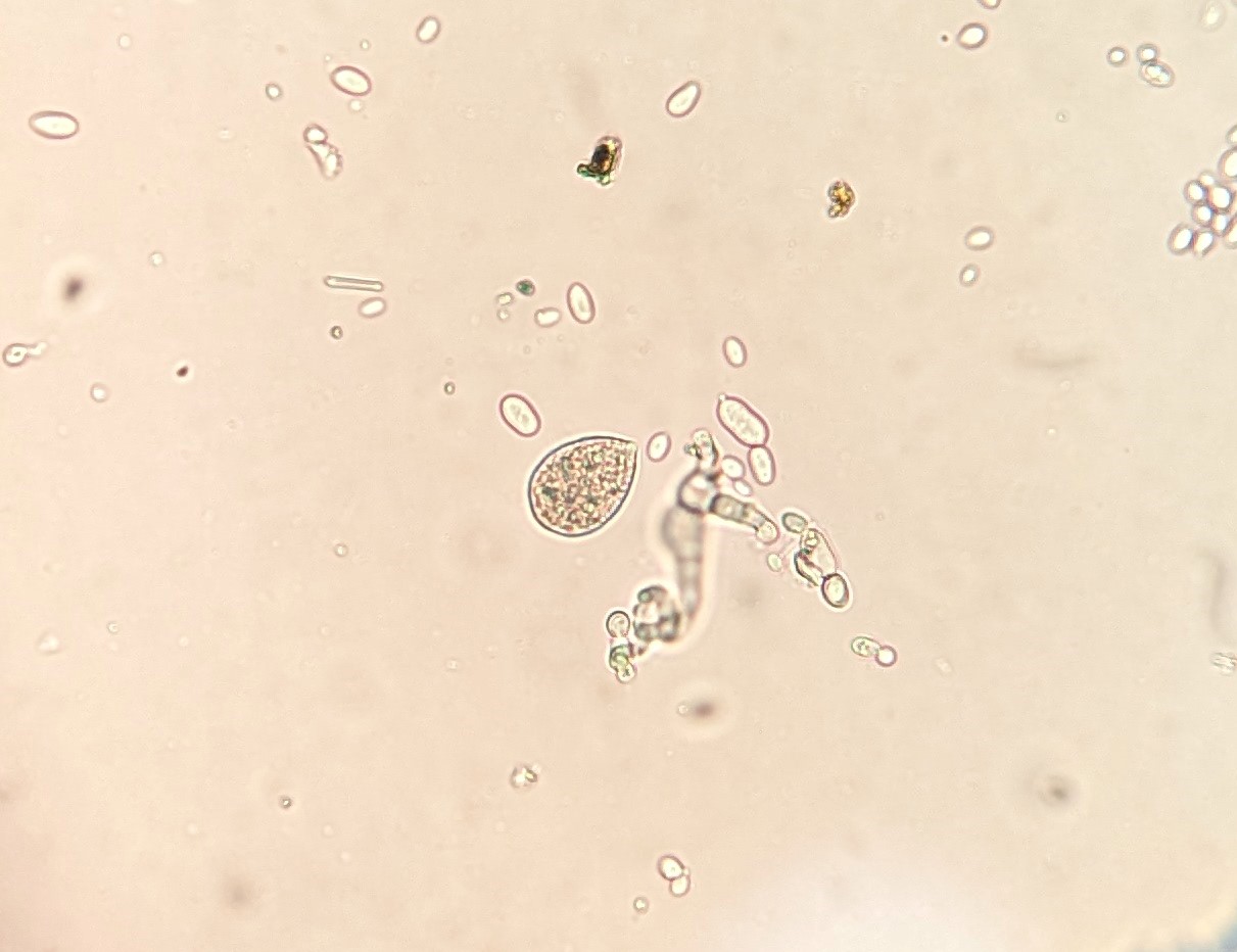 Downy mildew sporangia